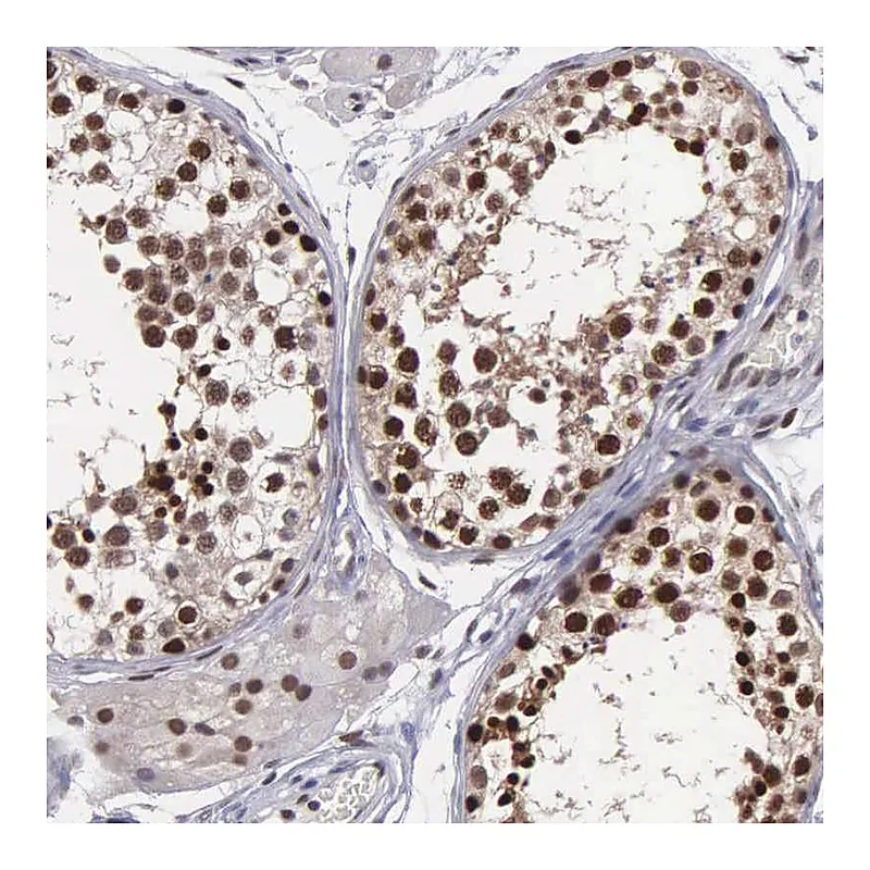 Atlas Antibodies Anti-UBR7 Antibody