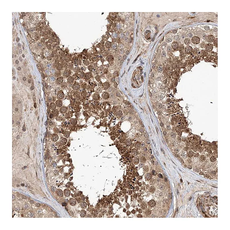 Atlas Antibodies Anti-UBTD2 Antibody