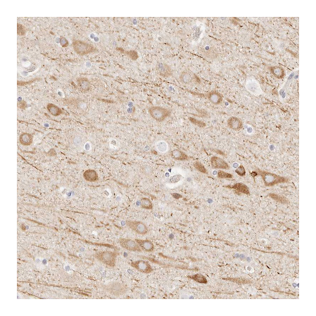 Atlas Antibodies Anti-UBXN10 Antibody