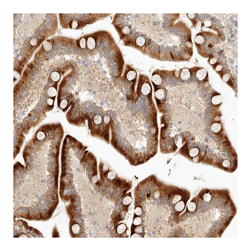 Atlas Antibodies Anti-UBXN11 Antibody