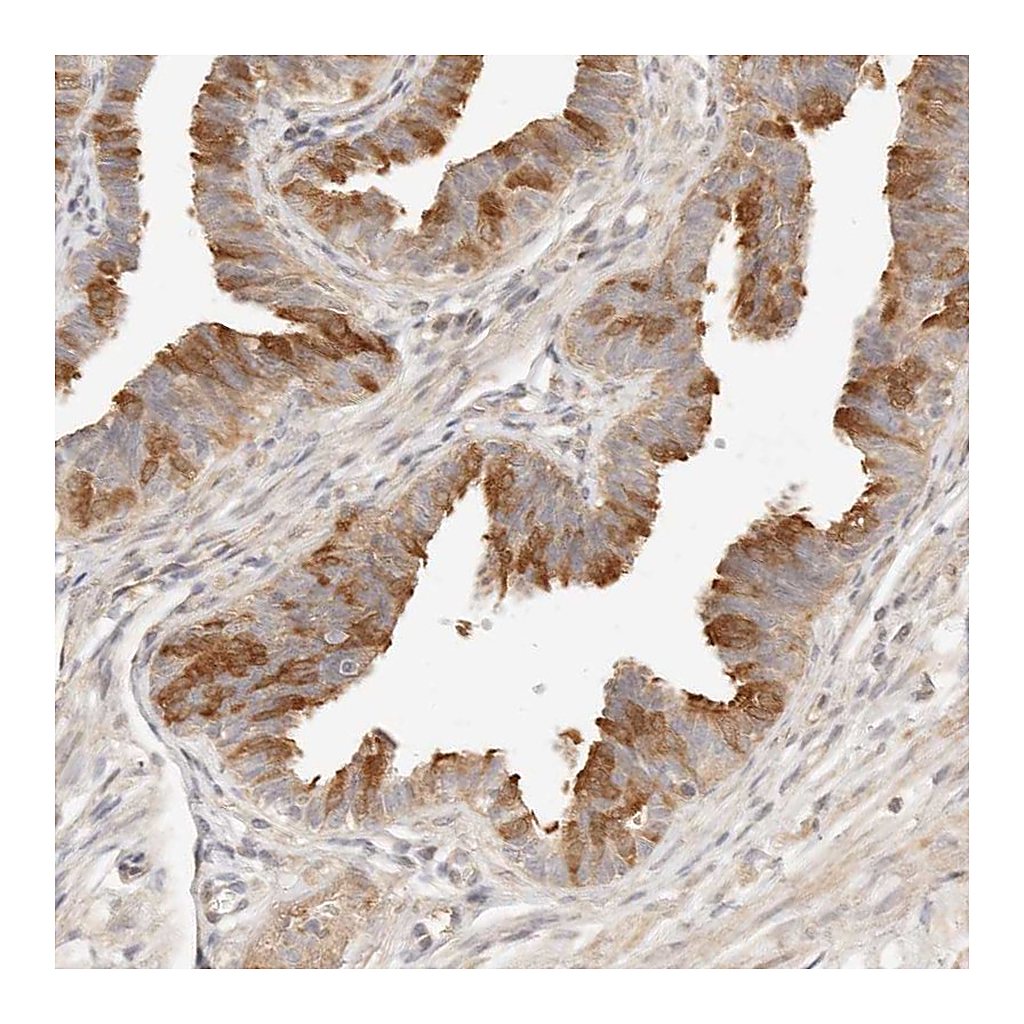 Atlas Antibodies Anti-UBXN10 Antibody