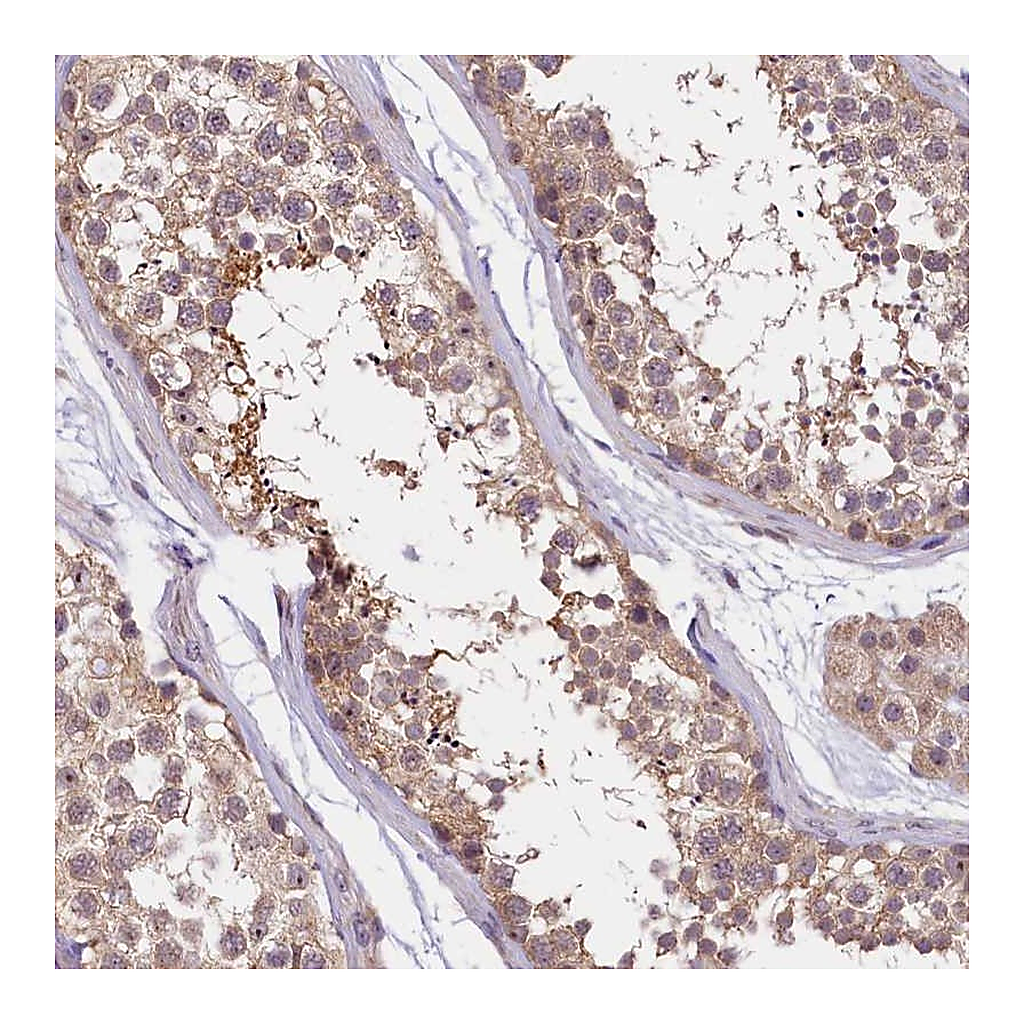 Atlas Antibodies Anti-UBXN6 Antibody