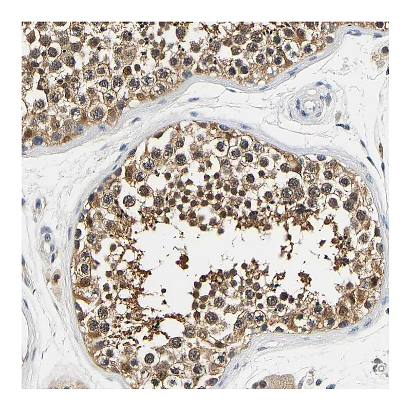 Atlas Antibodies Anti-UCHL3 Antibody