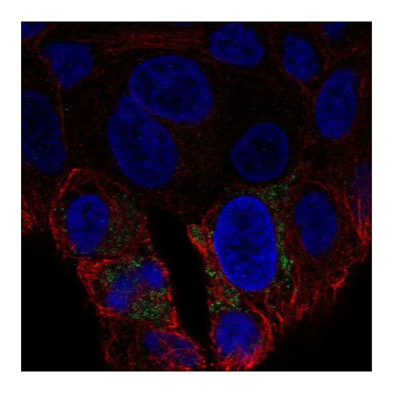 Atlas Antibodies Anti-UCP2 Antibody