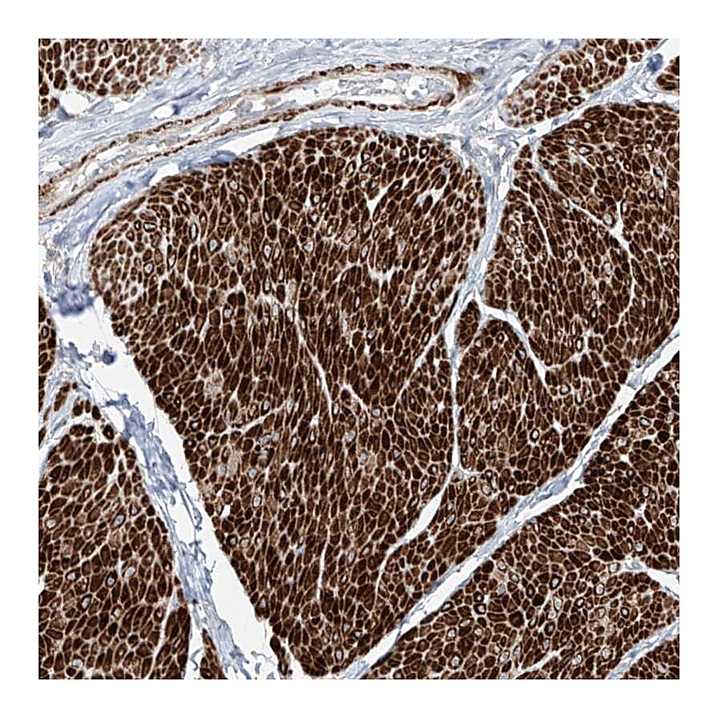 Atlas Antibodies Anti-UFD1L Antibody