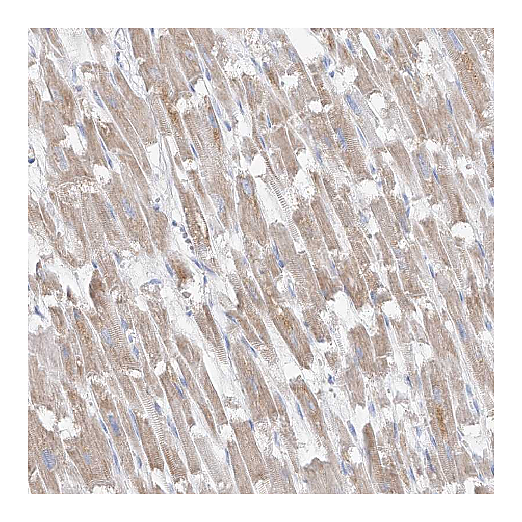 Atlas Antibodies Anti-UFL1 Antibody
