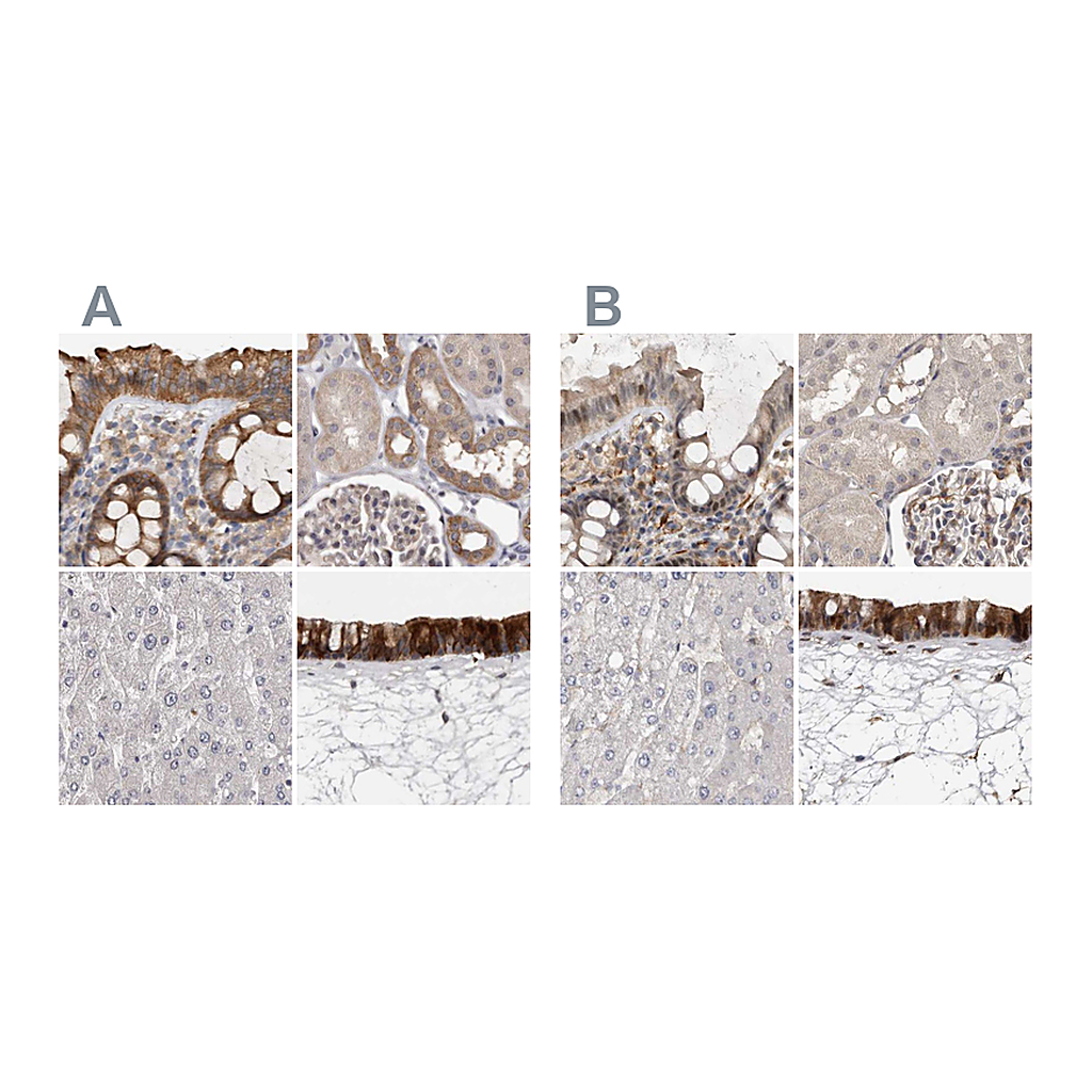 Atlas Antibodies Anti-UFC1 Antibody