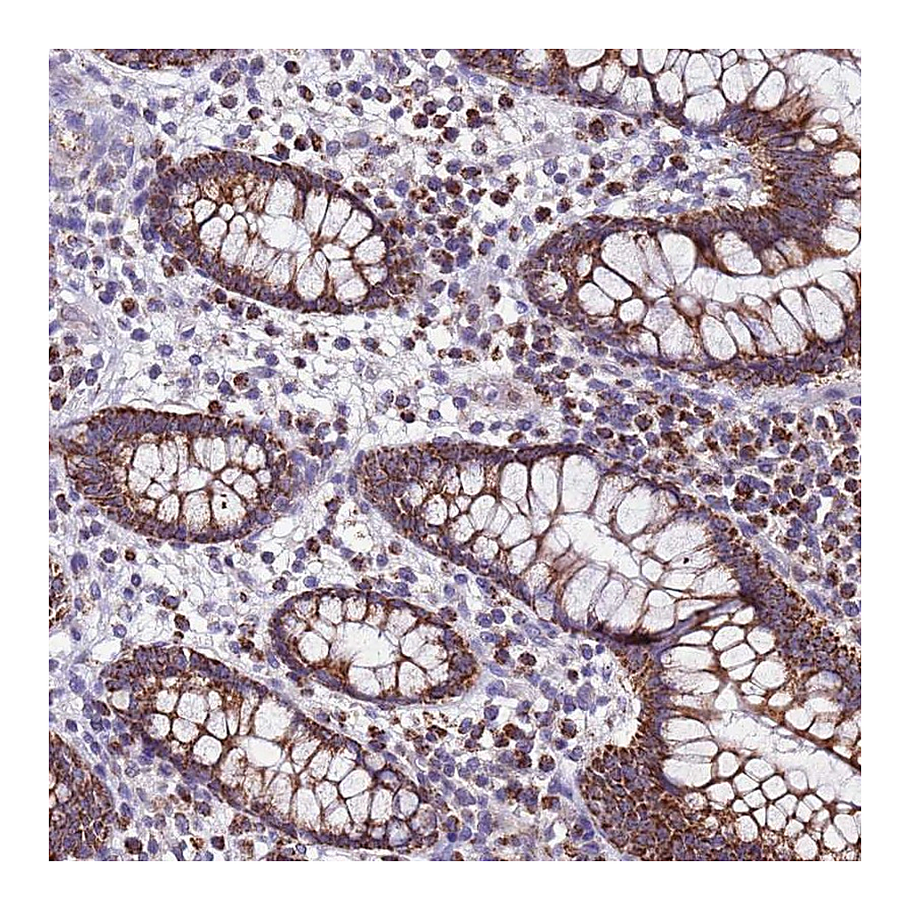 Atlas Antibodies Anti-UEVLD Antibody