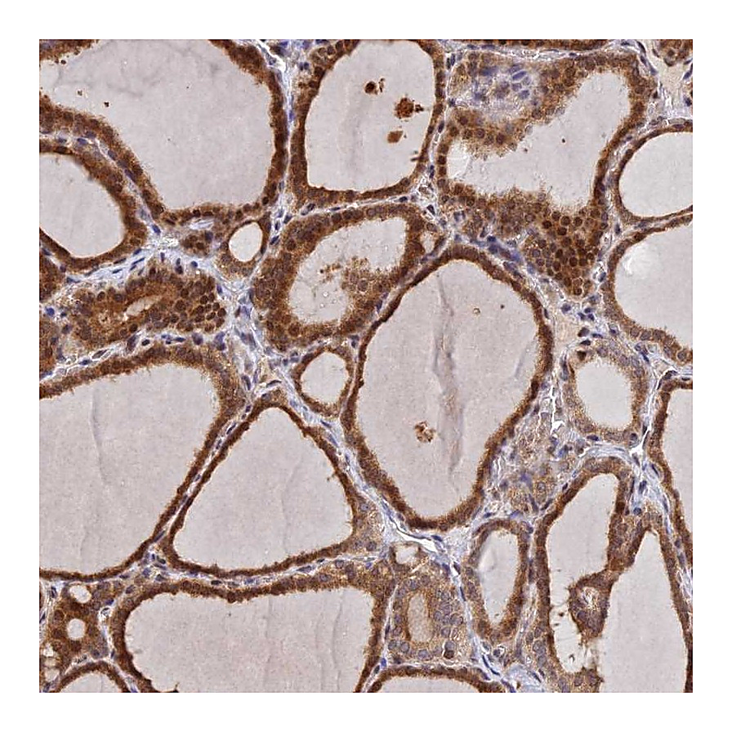 Atlas Antibodies Anti-UFSP2 Antibody