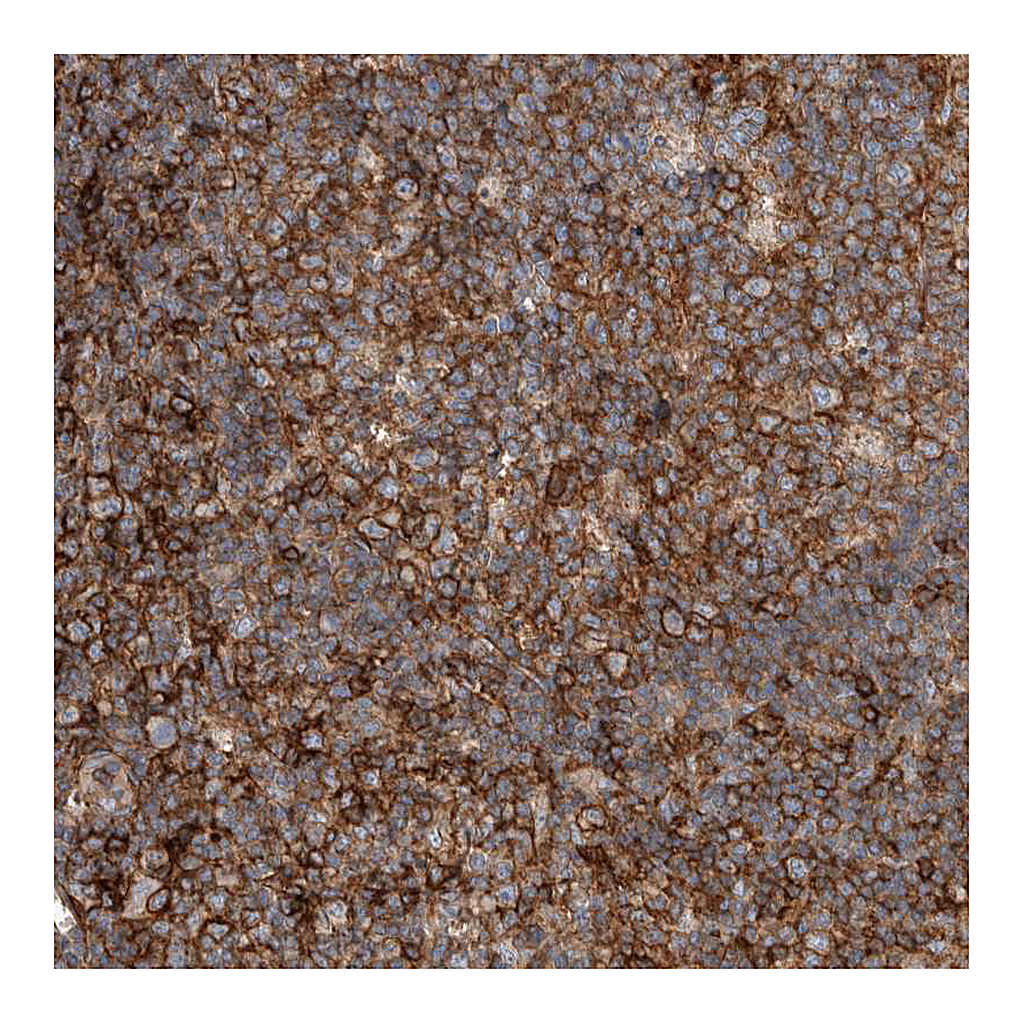 Atlas Antibodies Anti-UGCG Antibody