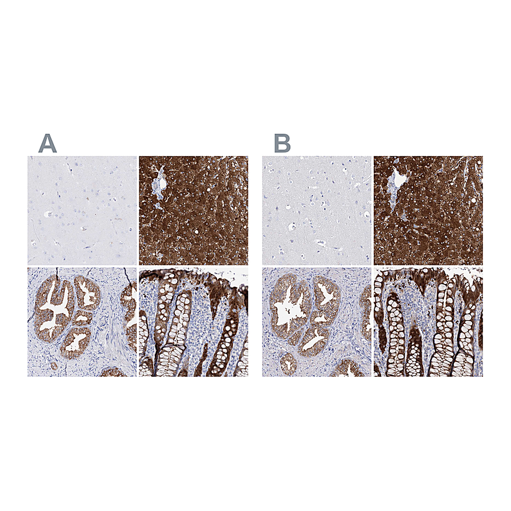 Atlas Antibodies Anti-UGDH Antibody