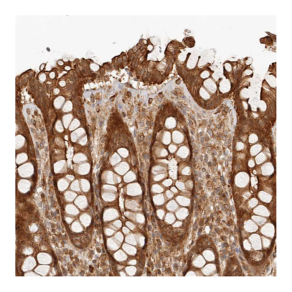 Atlas Antibodies Anti-UFSP1 Antibody