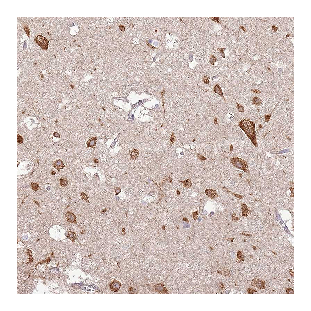 Atlas Antibodies Anti-UGGT2 Antibody