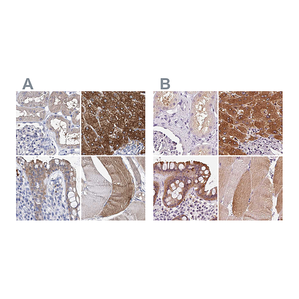 Atlas Antibodies Anti-UGP2 Antibody