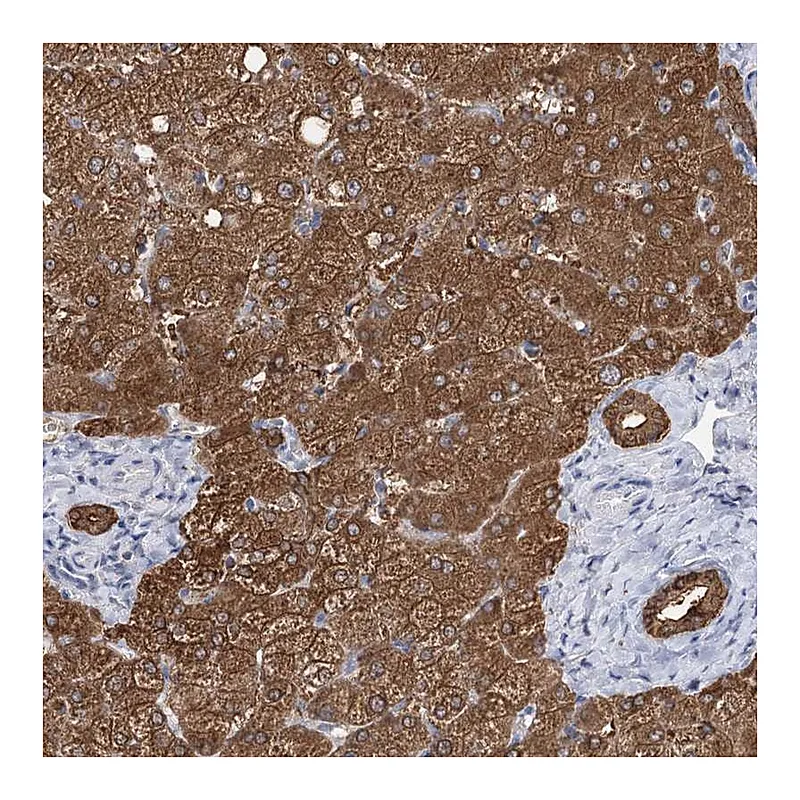 Atlas Antibodies Anti-UGP2 Antibody