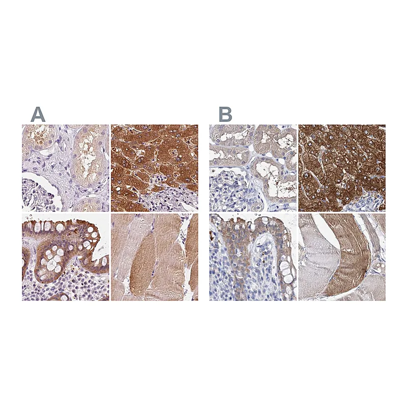 Atlas Antibodies Anti-UGP2 Antibody