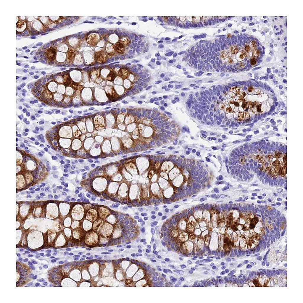 Atlas Antibodies Anti-UGT2B4 Antibody
