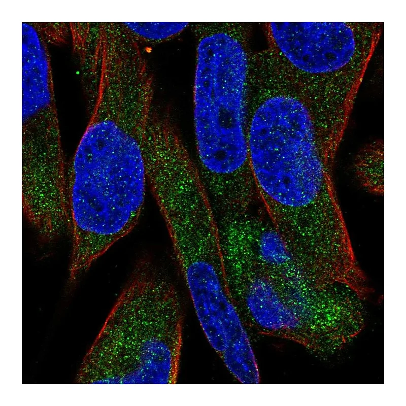 Atlas Antibodies Anti-UGT3A1 Antibody