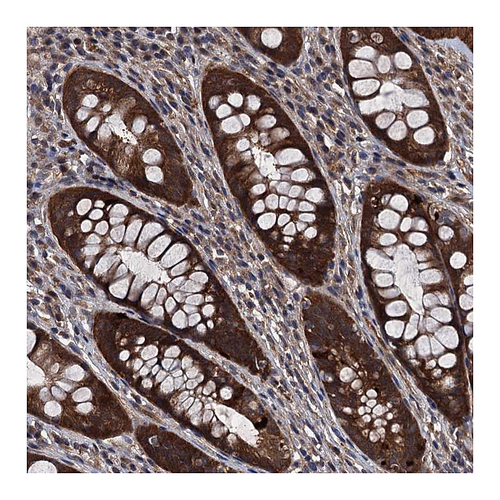 Atlas Antibodies Anti-UHRF1BP1L Antibody