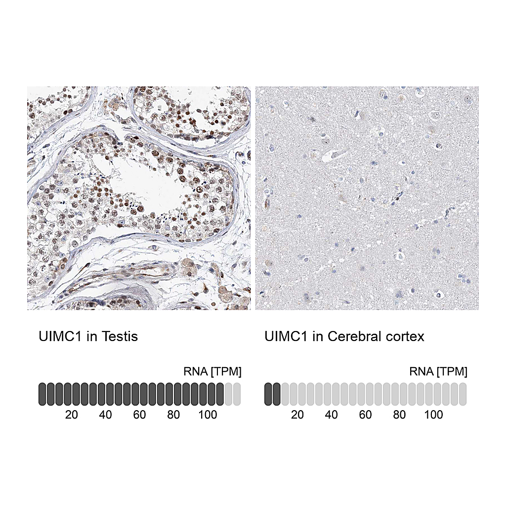 Atlas Antibodies Anti-UIMC1 Antibody