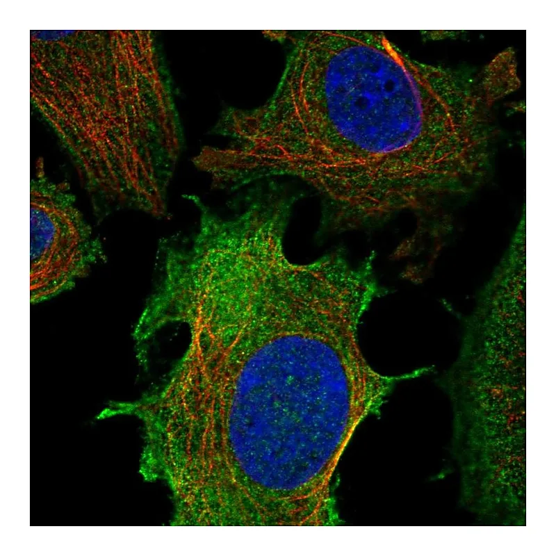 Atlas Antibodies Anti-ULBP1 Antibody