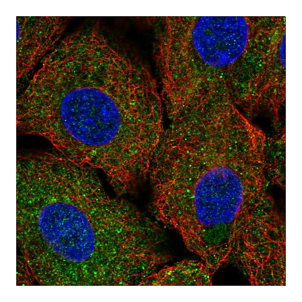 Atlas Antibodies Anti-ULK1 Antibody