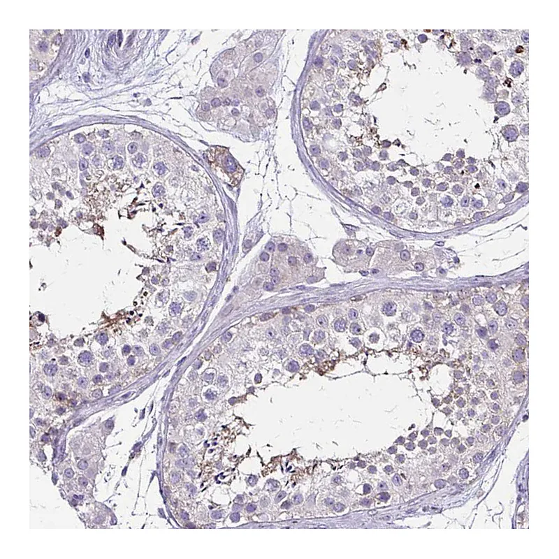 Atlas Antibodies Anti-ULBP3 Antibody