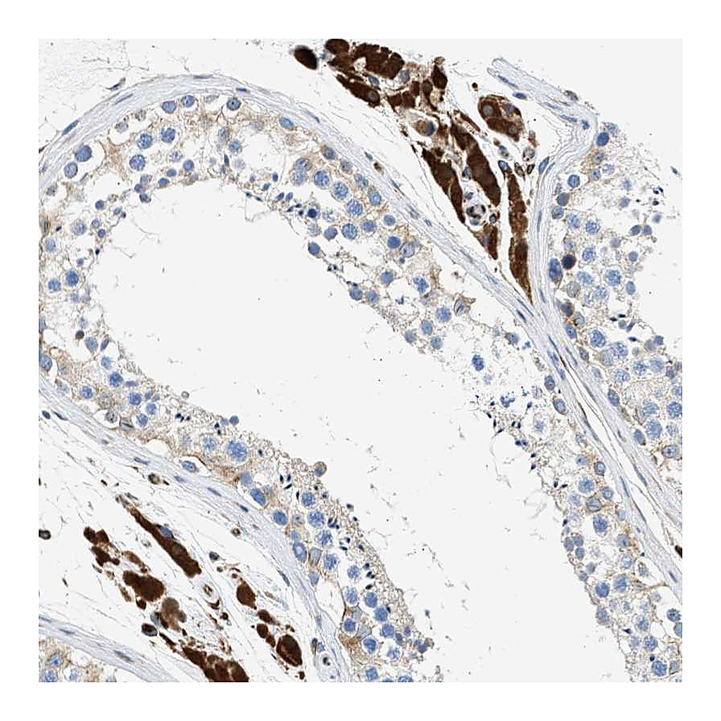 Atlas Antibodies Anti-ULK4 Antibody