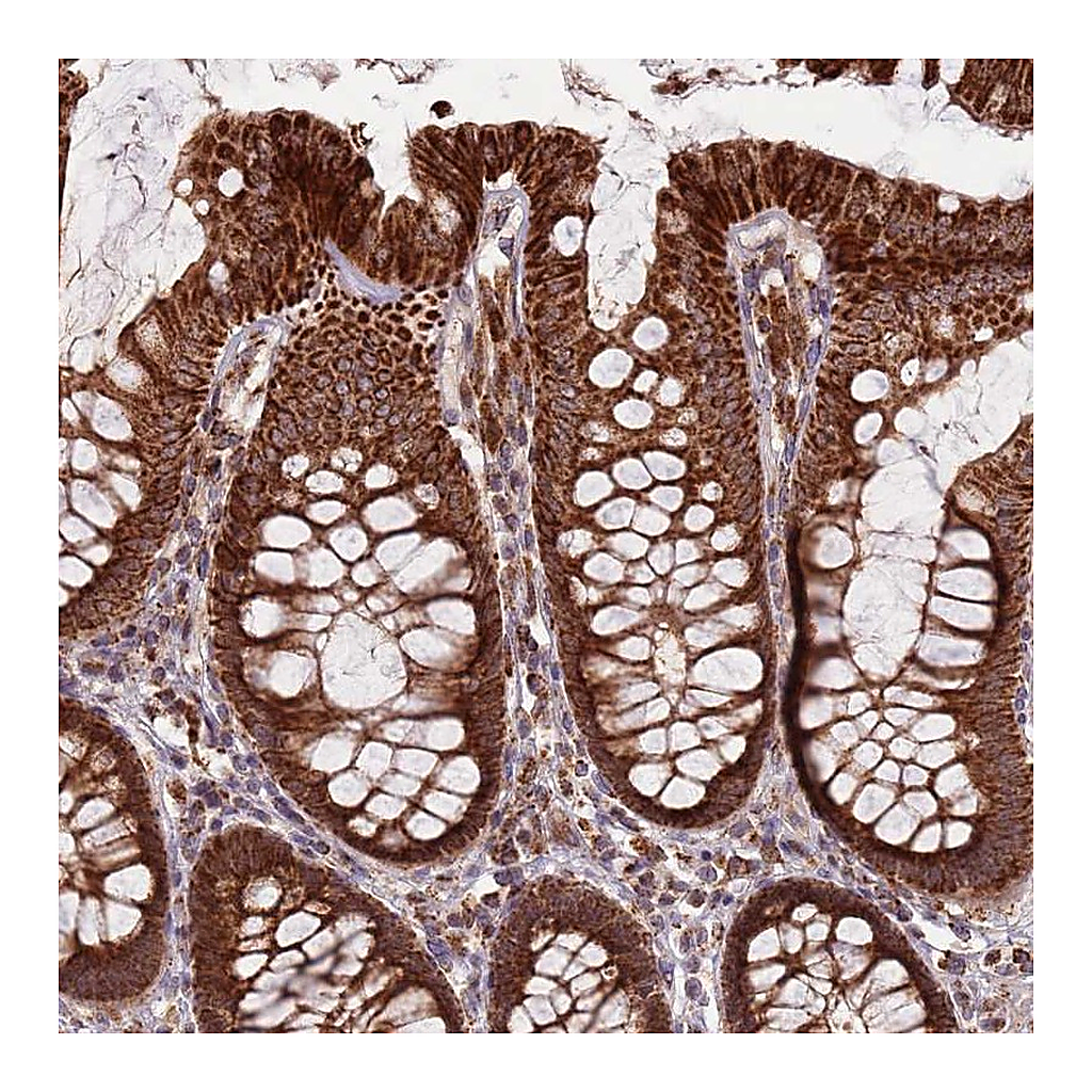 Atlas Antibodies Anti-ULK3 Antibody