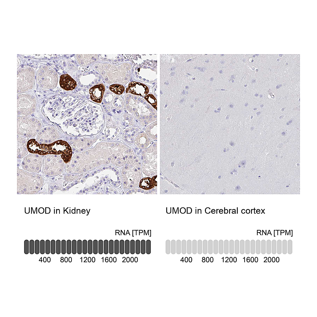 Atlas Antibodies Anti-UMOD Antibody