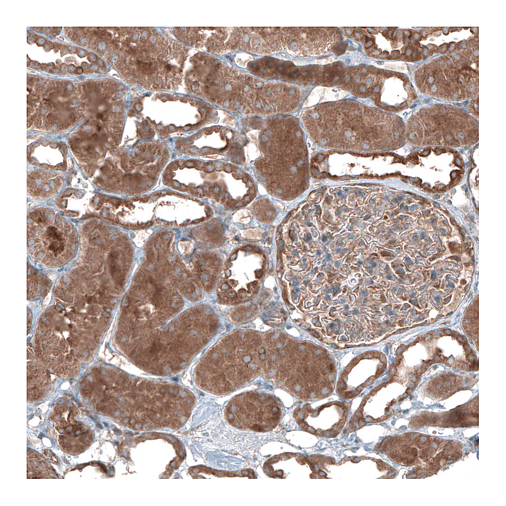 Atlas Antibodies Anti-UMPS Antibody
