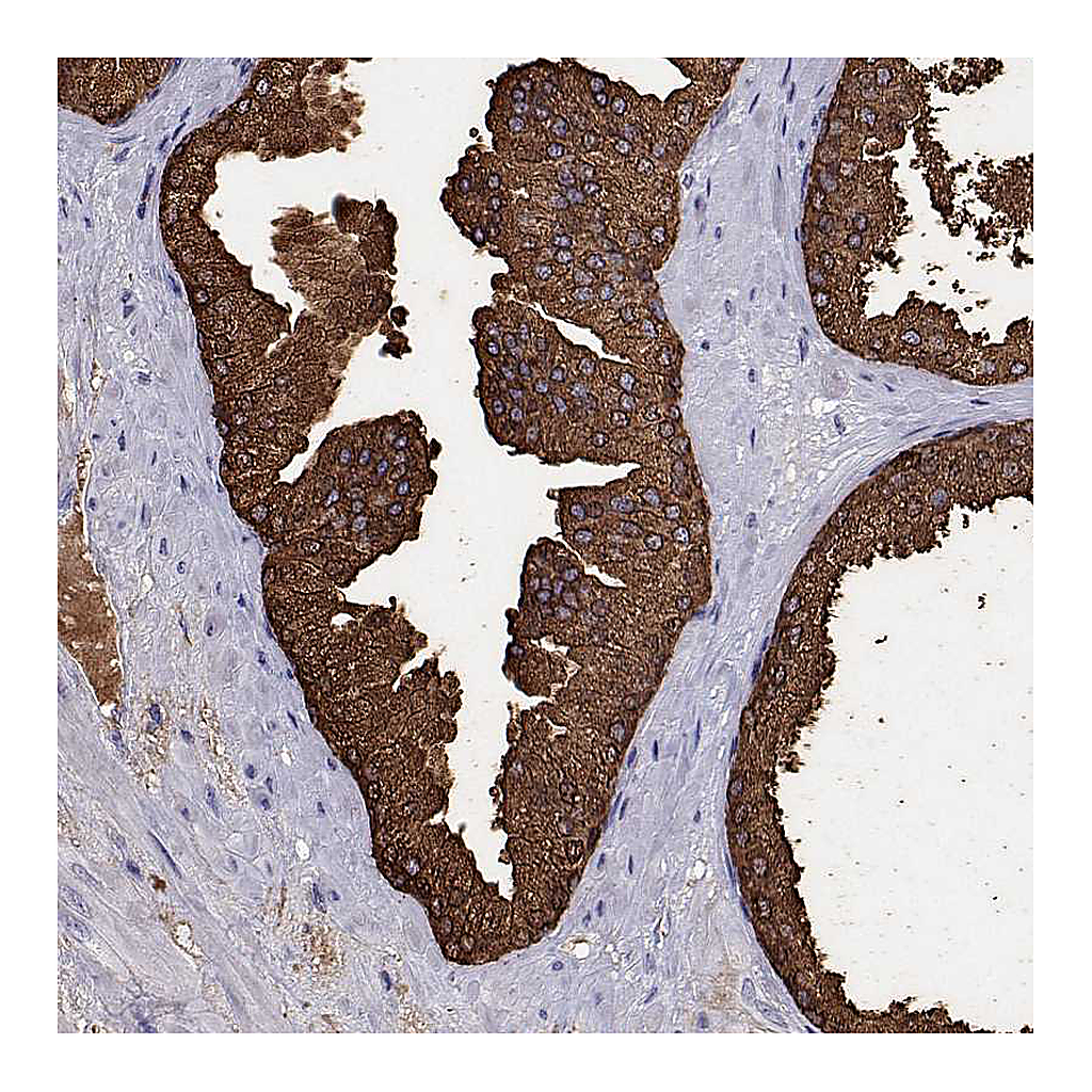 Atlas Antibodies Anti-UMODL1 Antibody