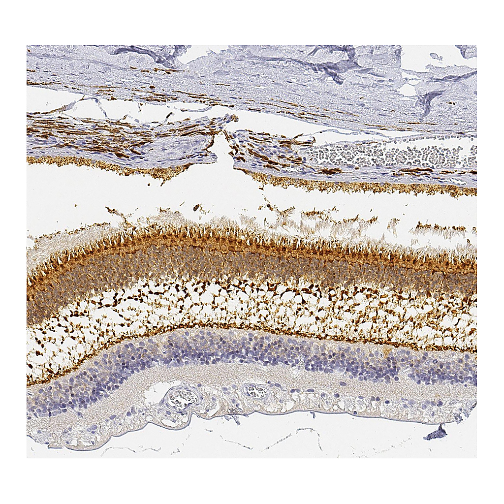 Atlas Antibodies Anti-UNC119 Antibody