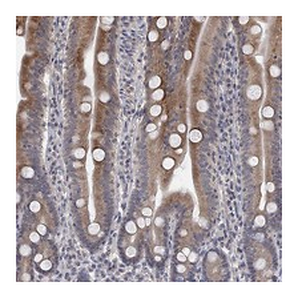 Atlas Antibodies Anti-UNC5B Antibody