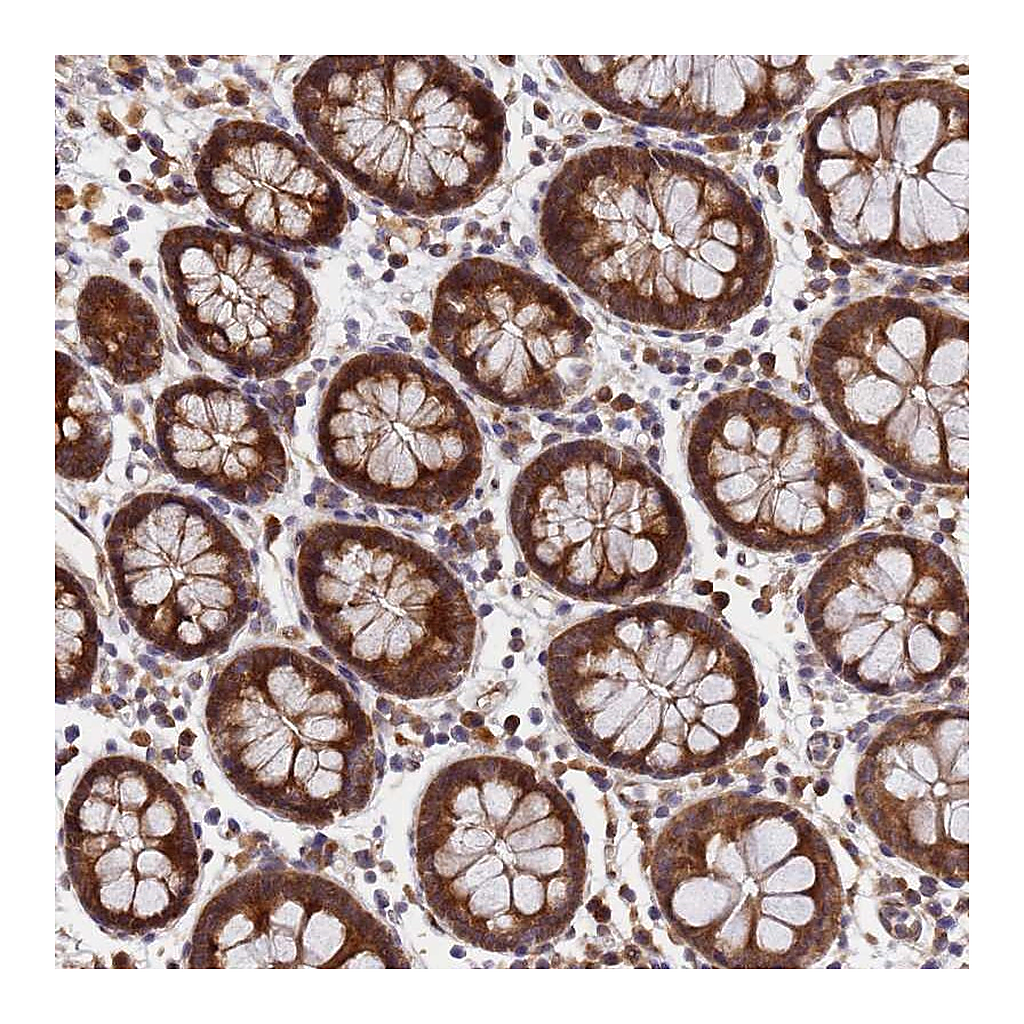 Atlas Antibodies Anti-UNC93B1 Antibody