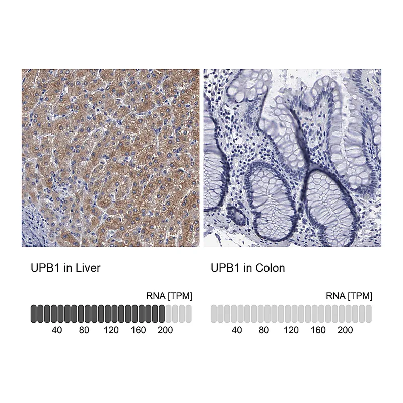 Atlas Antibodies Anti-UPB1 Antibody