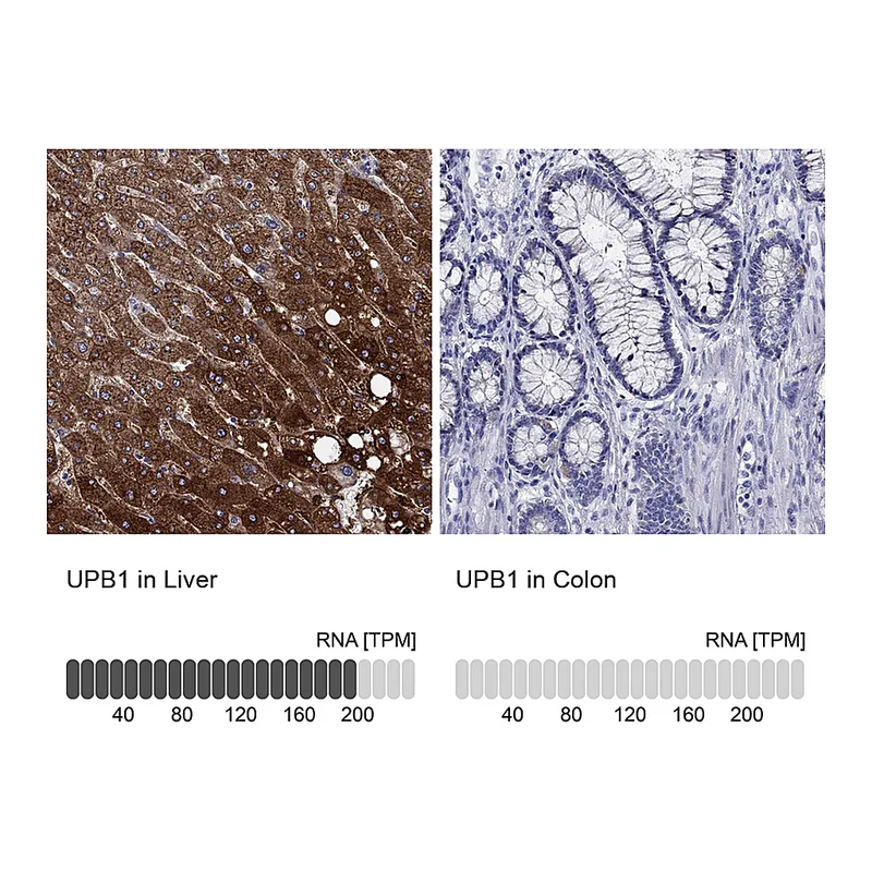 Atlas Antibodies Anti-UPB1 Antibody
