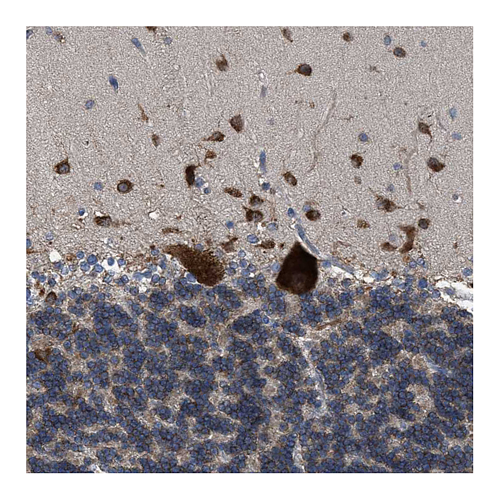 Atlas Antibodies Anti-UPF1 Antibody