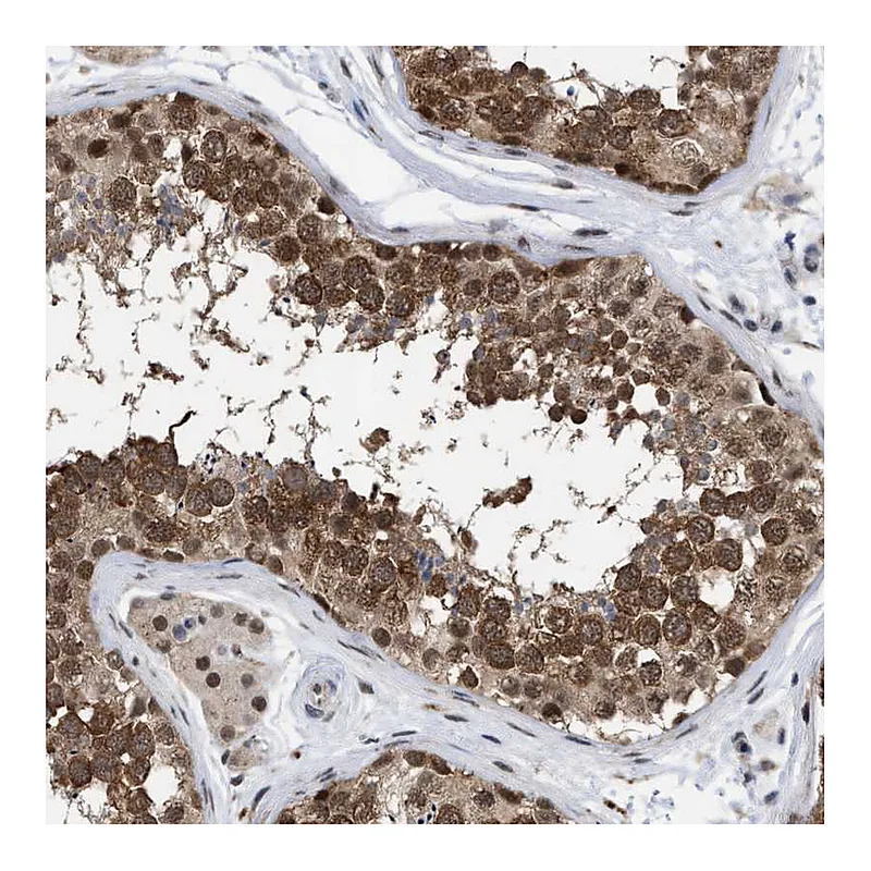 Atlas Antibodies Anti-UPF1 Antibody