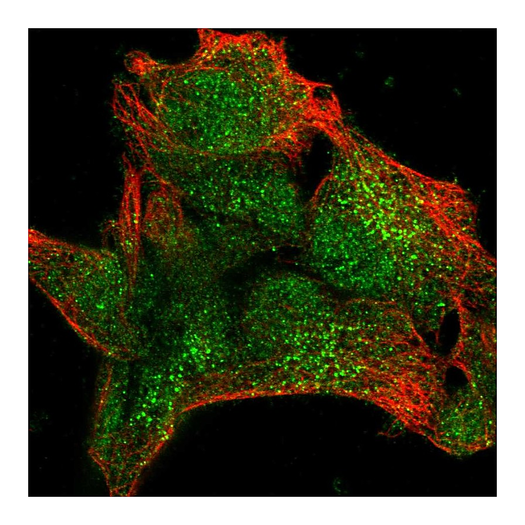 Atlas Antibodies Anti-UPF3A Antibody