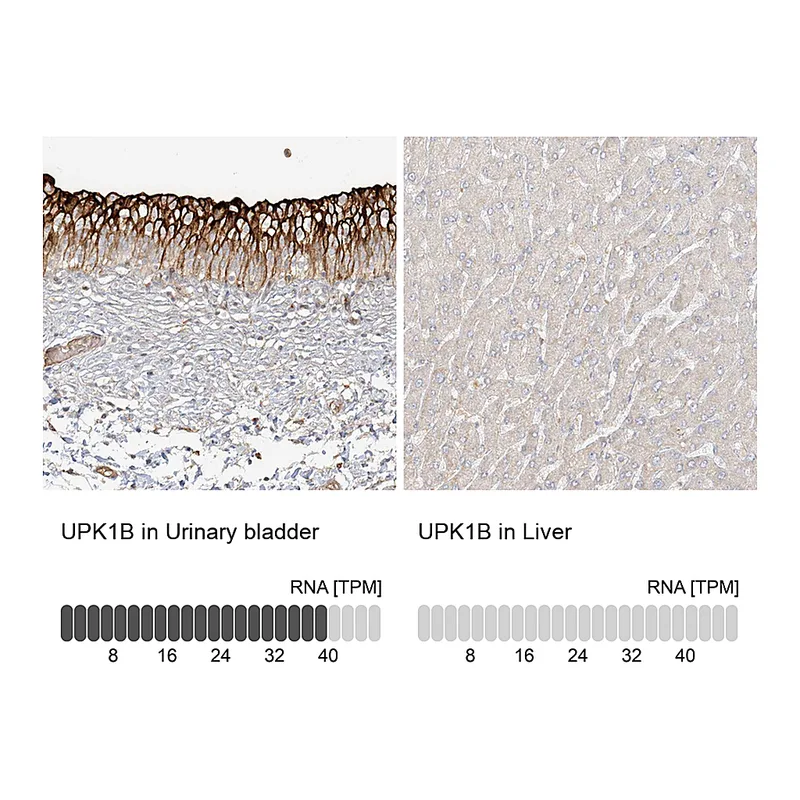 Atlas Antibodies Anti-UPK1B Antibody