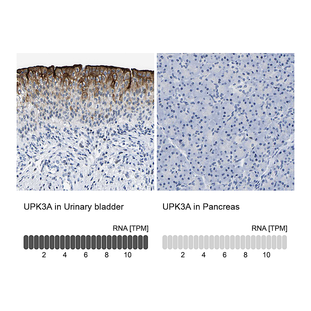 Atlas Antibodies Anti-UPK3A Antibody