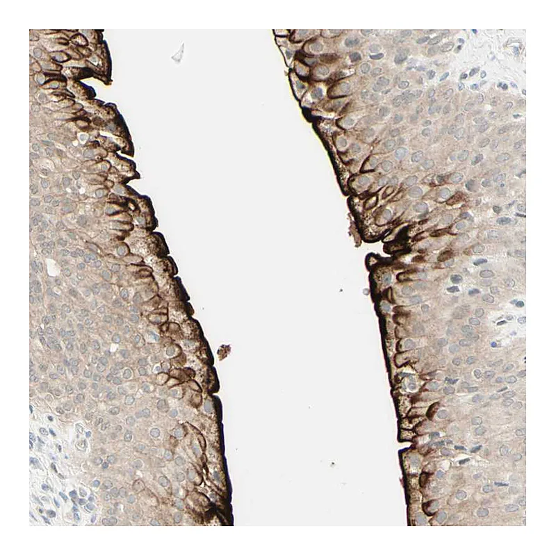 Atlas Antibodies Anti-UPK3B Antibody