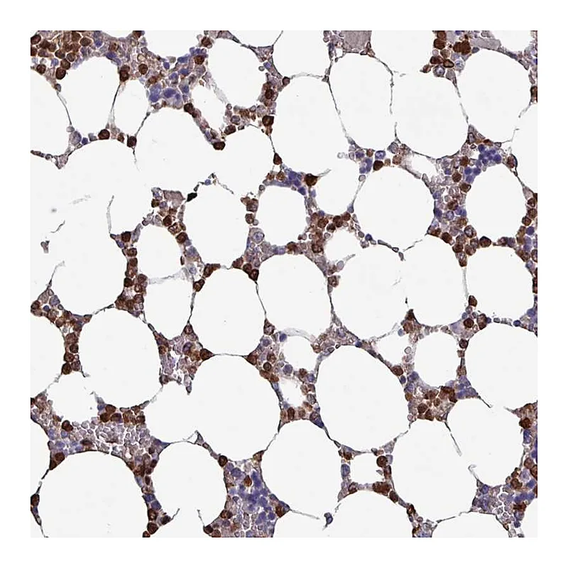 Atlas Antibodies Anti-UQCC2 Antibody