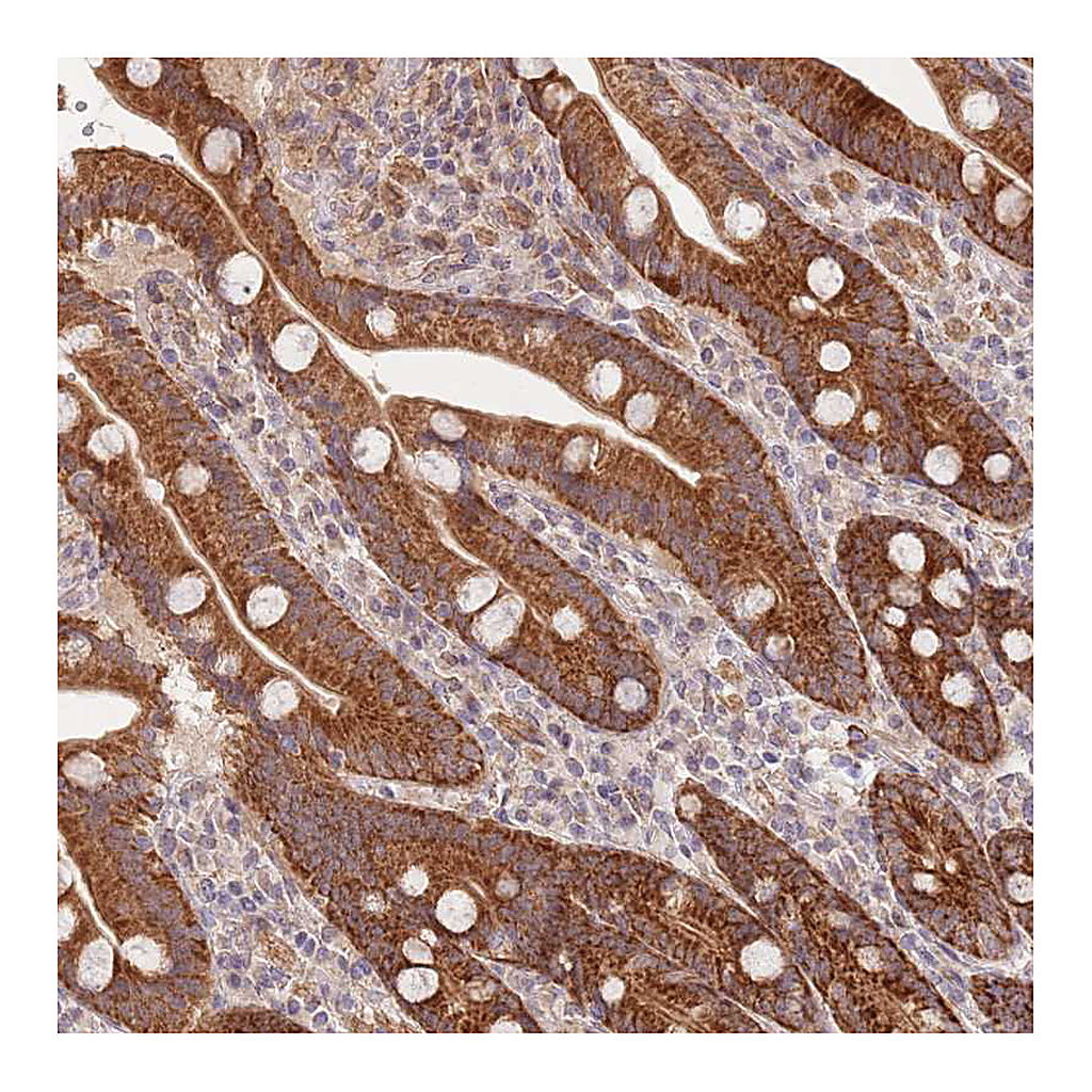 Atlas Antibodies Anti-UQCC3 Antibody