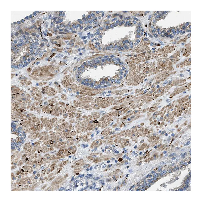Atlas Antibodies Anti-URGCP Antibody
