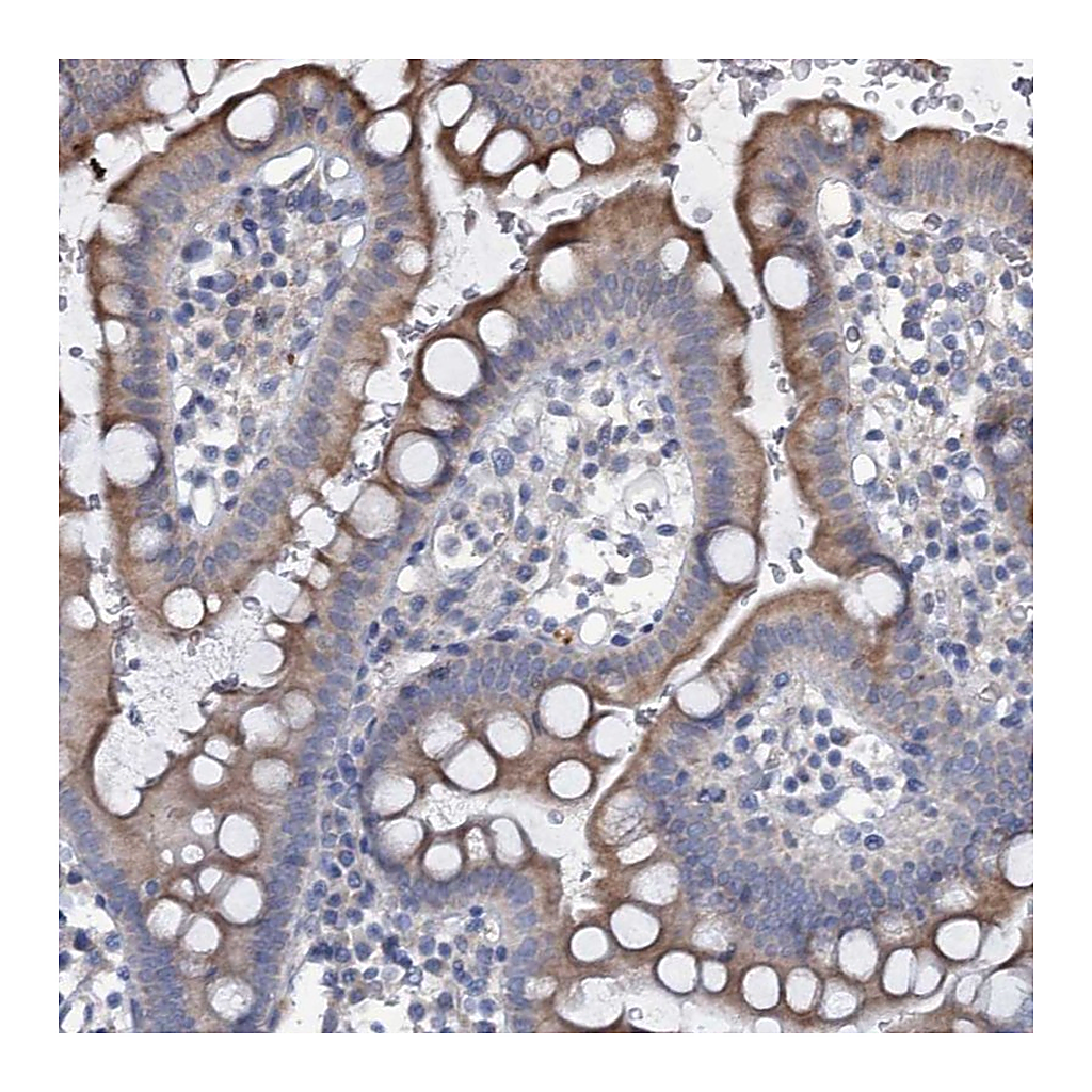 Atlas Antibodies Anti-URAD Antibody