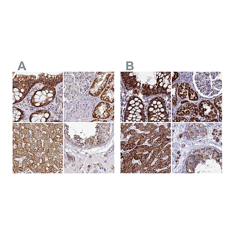 Atlas Antibodies Anti-UQCRFS1 Antibody
