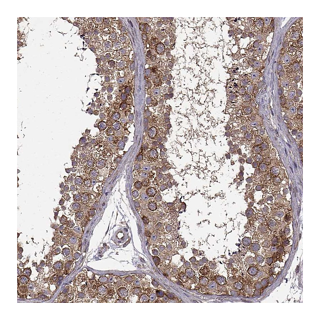 Atlas Antibodies Anti-URI1 Antibody