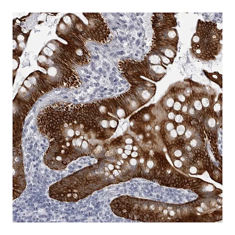 Atlas Antibodies Anti-UROD Antibody